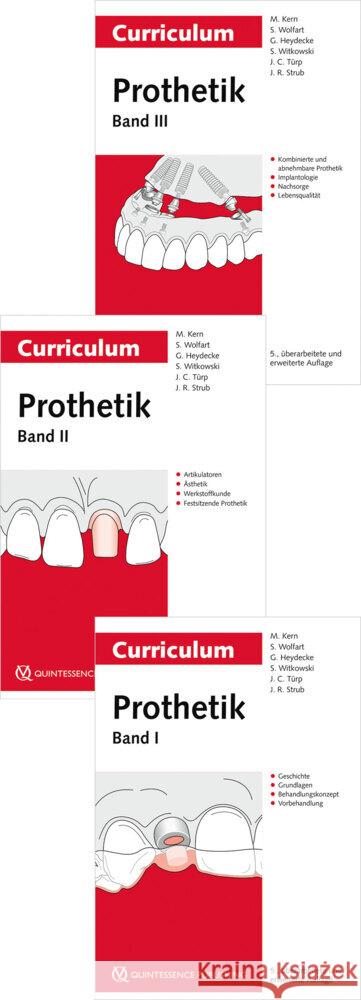 Curriculum Prothetik, 3 Teile Kern, Matthias, Wolfart, Stefan, Heydecke, Guido 9783868675726