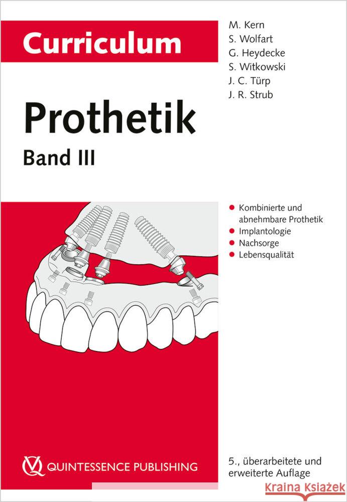 Curriculum Prothetik Band 3 Kern, Matthias, Wolfart, Stefan, Heydecke, Guido 9783868675757