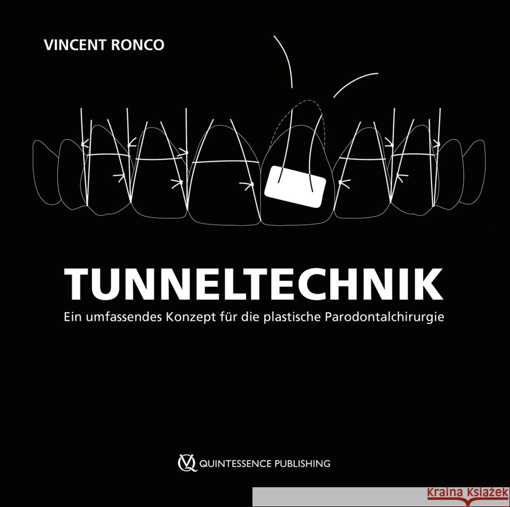 Tunneltechnik Ronco, Vincent 9783868677188