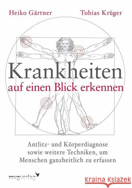 Krankheiten auf einen Blick erkennen : Antlitz- und Körperdiagnose sowie weitere Techniken, um Menschen ganzheitlich zu erfassen Gärtner, Heiko; Krüger, Tobias 9783868824490 mvg Verlag