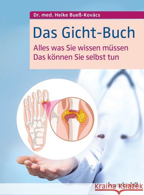 Das Gicht-Buch : Alles, was Sie wissen müssen. Das können Sie selbst tun Bueß-Kovács, Heike 9783869100791