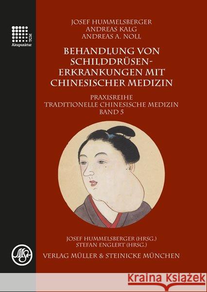 Behandlung von Schilddrüsenerkrankungen mit chinesischer Medizin Hummelsberger, Josef; Kalg, Andreas; Noll, Andreas, A. 9783875692303