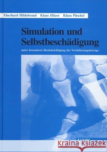 Simulation und Selbstbeschädigung : Unter besonderer Berücksichtigung des Versicherungsbetrugs Hildebrand, Eberhard; Hitzer, Klaus; Püschel, Klaus 9783884879061