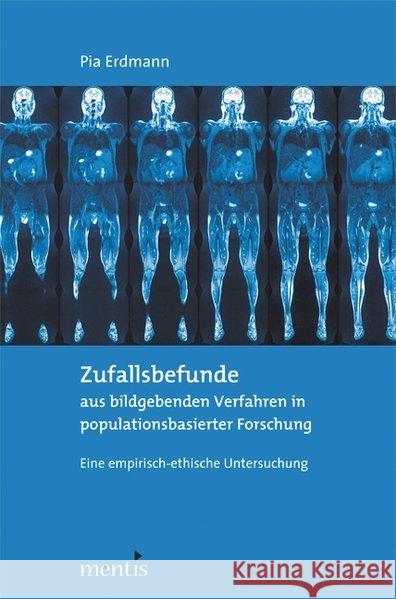 Zufallsbefunde Aus Bildgebenden Verfahren in Populationsbasierter Forschung: Eine Empirisch-Ethische Untersuchung Erdmann, Pia 9783897850705 mentis-Verlag