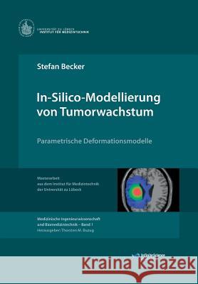 In-Silico-Modellierung von Tumorwachstum Becker, Stefan 9783945954027 Infinite Science Publishing