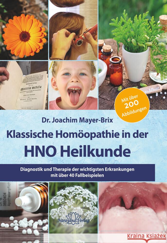 Klassische Homöopathie in der HNO-Heilkunde Mayer-Brix, Joachim 9783955822064