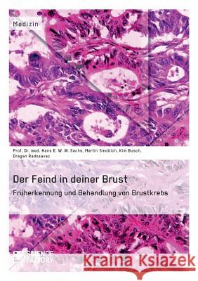 Der Feind in deiner Brust. Früherkennung und Behandlung von Brustkrebs Smollich, Martin 9783956871214 Science Factory