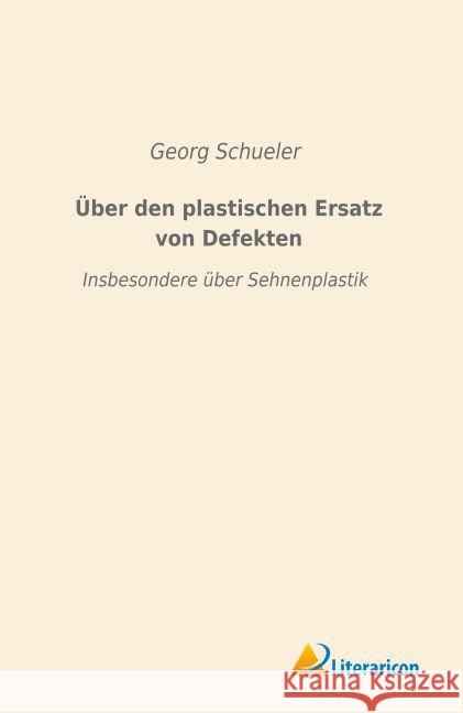 Über den plastischen Ersatz von Defekten : Insbesondere über Sehnenplastik Schueler, Georg 9783956978098