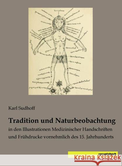 Tradition und Naturbeobachtung : in den Illustrationen Medizinischer Handschriften und Frühdrucke vornehmlich des 15. Jahrhunderts Sudhoff, Karl 9783957702449