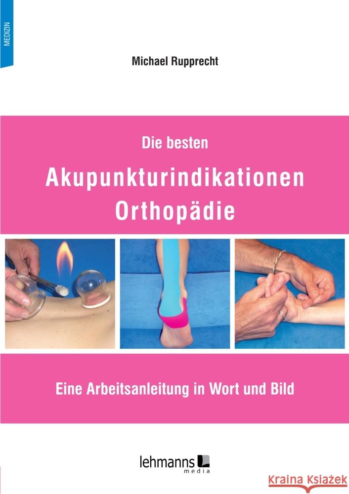 Die besten Akupunkturindikationen Orthopädie Rupprecht, Michael 9783965434127