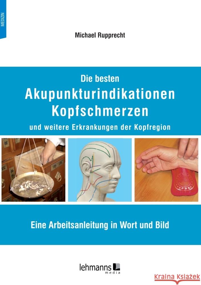 Die besten Akupunkturindikationen Kopfschmerzen und weitere Erkrankungen der Kopfregion Rupprecht, Michael 9783965434196