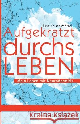 Aufgekratzt durchs Leben. Mein Leben mit Neurodermitis Reiser-W 9783969710753