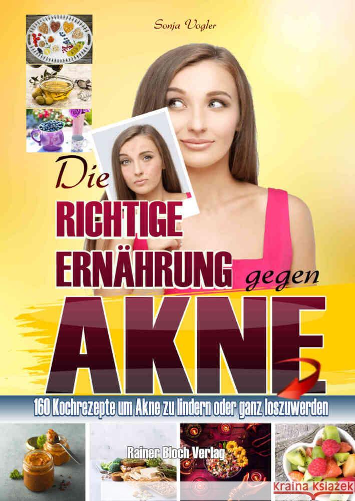 Die richtige Ernährung gegen Akne Vogler, Sonja 9783982224534