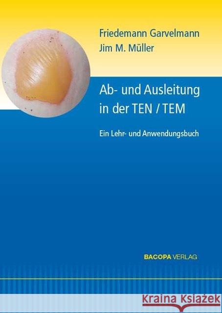 Ab- und Ausleitungsverfahren in der TEN/TEM. Garvelmann, Friedemann, Müller, Jim M. 9783991140153 Bacopa