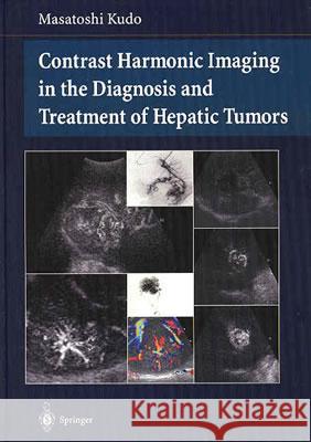 Contrast Harmonic Imaging in the Diagnosis and Treatment of Hepatic Tumors Masatoshi Kudo 9784431000020 Springer