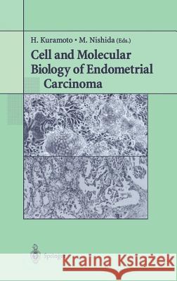 Cell and Molecular Biology of Endometrial Carcinoma Hiroyuki Kuramoto Masato Nishida H. Kuramoto 9784431006138 Springer