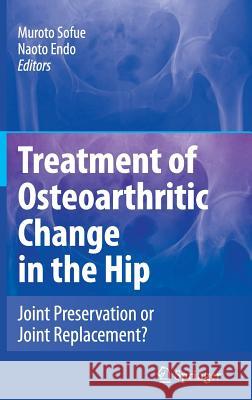 Treatment of Osteoarthritic Change in the Hip: Joint Preservation or Joint Replacement? Sofue, M. 9784431381983 Springer