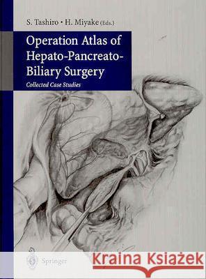 Operation Atlas of Hepato-Pancreato-Biliary Surgery: Collected Case Studies S. Tashiro H. Miyake 9784431402794 Springer