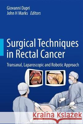Surgical Techniques in Rectal Cancer: Transanal, Laparoscopic and Robotic Approach Dapri, Giovanni 9784431555780 Springer