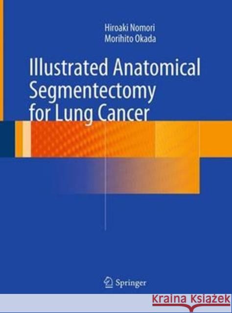Illustrated Anatomical Segmentectomy for Lung Cancer Nomori, Hiroaki|||Okada, Morihito 9784431561217 