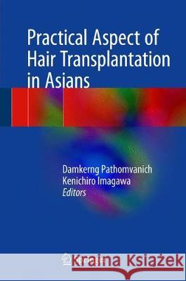 Practical Aspects of Hair Transplantation in Asians Damkerng Pathomvanich Kenichiro Imagawa Robert Haber 9784431565451 Springer