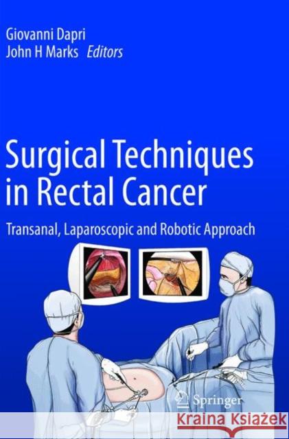 Surgical Techniques in Rectal Cancer: Transanal, Laparoscopic and Robotic Approach Dapri, Giovanni 9784431566632 Springer