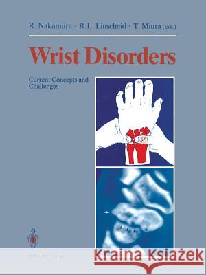 Wrist Disorders: Current Concepts and Challenges Nakamura, Ryogo 9784431658764 Springer