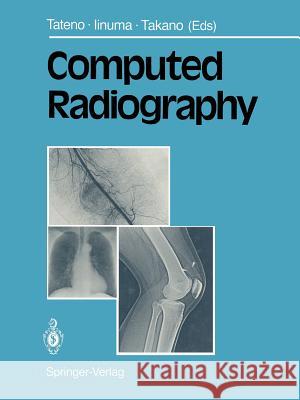 Computed Radiography Yukio Tateno Takeshi Iinuma Masao Takano 9784431668862 Springer