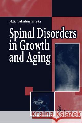 Spinal Disorders in Growth and Aging Hideaki E. Takahashi 9784431669418 Springer
