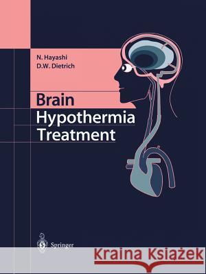 Brain Hypothermia Treatment Nariyuki Hayashi Dalton W. Dietrich Dalton W 9784431679646 Springer