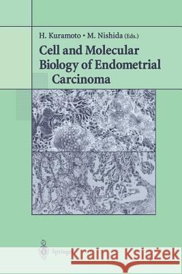 Cell and Molecular Biology of Endometrial Carcinoma H. Kuramoto M. Nishida 9784431679776 Springer