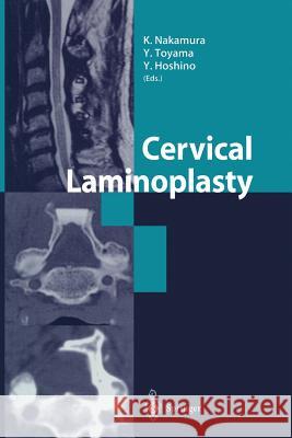 Cervical Laminoplasty K. Nakamura Y. Toyama Y. Hoshino 9784431679783 Springer