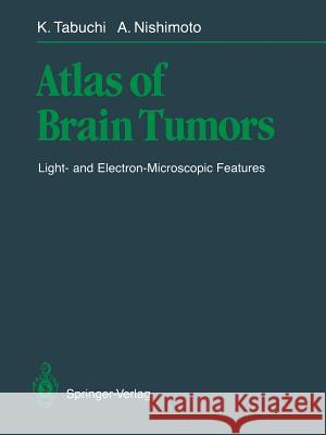 Atlas of Brain Tumors: Light- And Electron-Microscopic Features Tabuchi, Kazuo 9784431680659 Springer