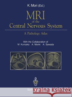 MRI of the Central Nervous System: A Pathology Atlas Mori, Koreaki 9784431681373 Springer