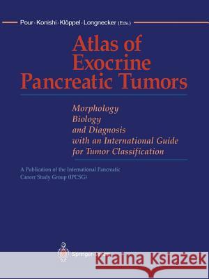 Atlas of Exocrine Pancreatic Tumors: Morphology, Biology, and Diagnosis with an International Guide for Tumor Classification Pour, Parviz M. 9784431683131 Springer