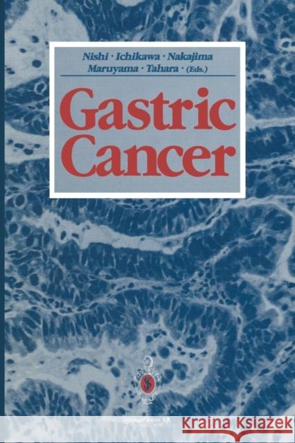 Gastric Cancer Mitsumasa Nishi Heizaburo Ichikawa Toshifusa Nakajima 9784431683308 Springer