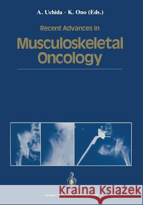 Recent Advances in Musculoskeletal Oncology Atsumasa Uchida Keiro Ono 9784431683667 Springer