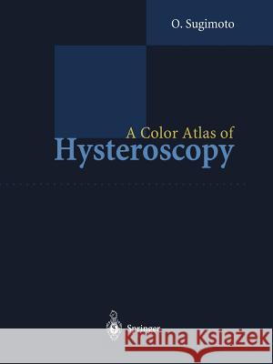 A Color Atlas of Hysteroscopy Osamu Sugimoto 9784431683933