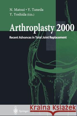 Arthroplasty 2000: Recent Advances in Total Joint Replacement Matsui, N. 9784431684299 Springer