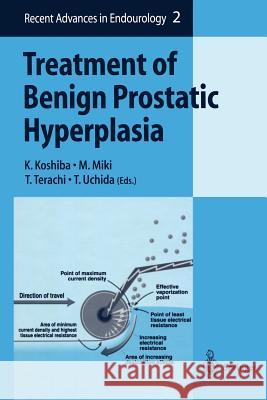 Treatment of Benign Prostatic Hyperplasia K. Koshiba M. Miki T. Terachi 9784431684466 Springer