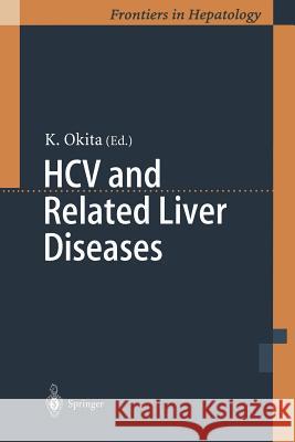 Hcv and Related Liver Diseases Okita, Kiwamu 9784431684909 Springer