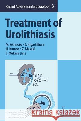 Treatment of Urolithiasis M. Akimoto E. Higashihara H. Kumon 9784431685197 Springer