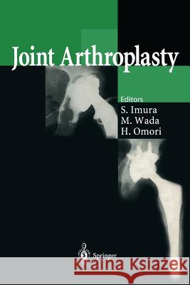 Joint Arthroplasty Shinichi Imura Makoto Wada Hironori Omori 9784431685319