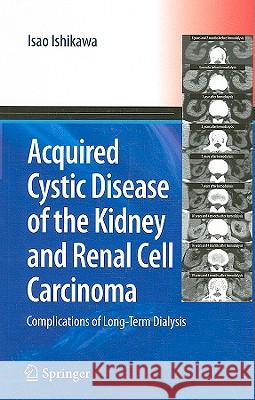 Acquired Cystic Disease of the Kidney and Renal Cell Carcinoma: Complication of Long-Term Dialysis Ishikawa, Isao 9784431694793 Springer