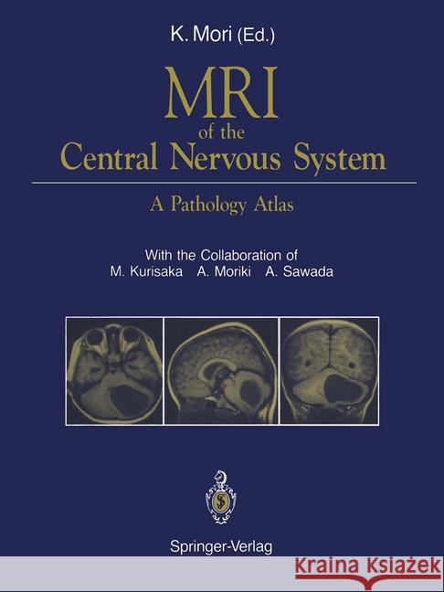 MRI of the Central Nervous System: A Pathology Atlas Mori, Koreaki 9784431700692 Springer