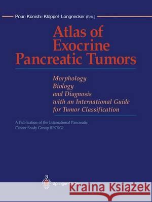 Atlas of Exocrine Pancreatic Tumors: Morphology, Biology, and Diagnosis with an International Guide for Tumor Classification Pour, Parviz M. 9784431701293 Springer