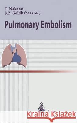 Pulmonary Embolism Takeshi Nakano Samuel Z. Goldhaber T. Nakano 9784431702382