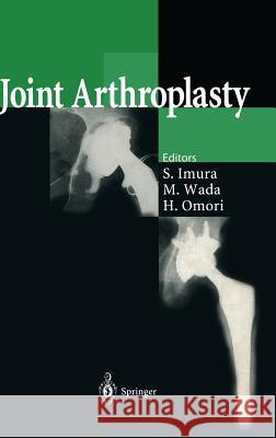 Joint Arthroplasty Makoto Wada Hironori Omori S. Imura 9784431702412