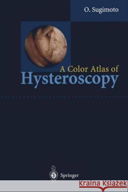 A Color Atlas of Hysteroscopy Sugimoto, Osamu 9784431702443