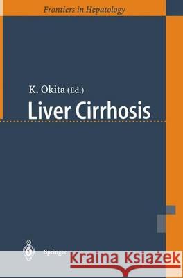 Liver Cirrhosis K. Okita Kiwamu Okita K. Okita 9784431702948 Springer Japan